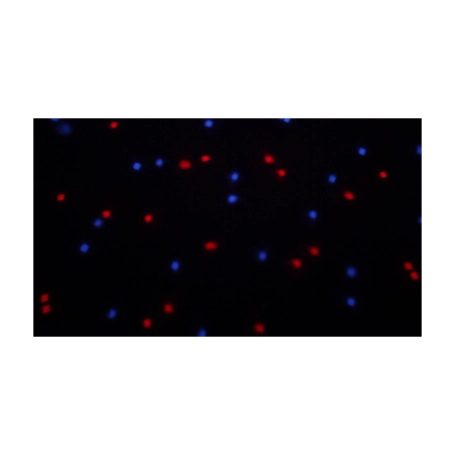  image 4 ORFX100 StarBall LED Lighting Effect